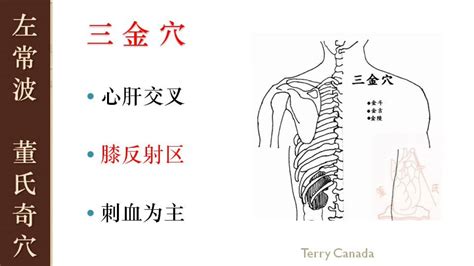 三金穴|董氏奇穴针灸：合金，分金穴 l 内金穴 【穴位讲解】